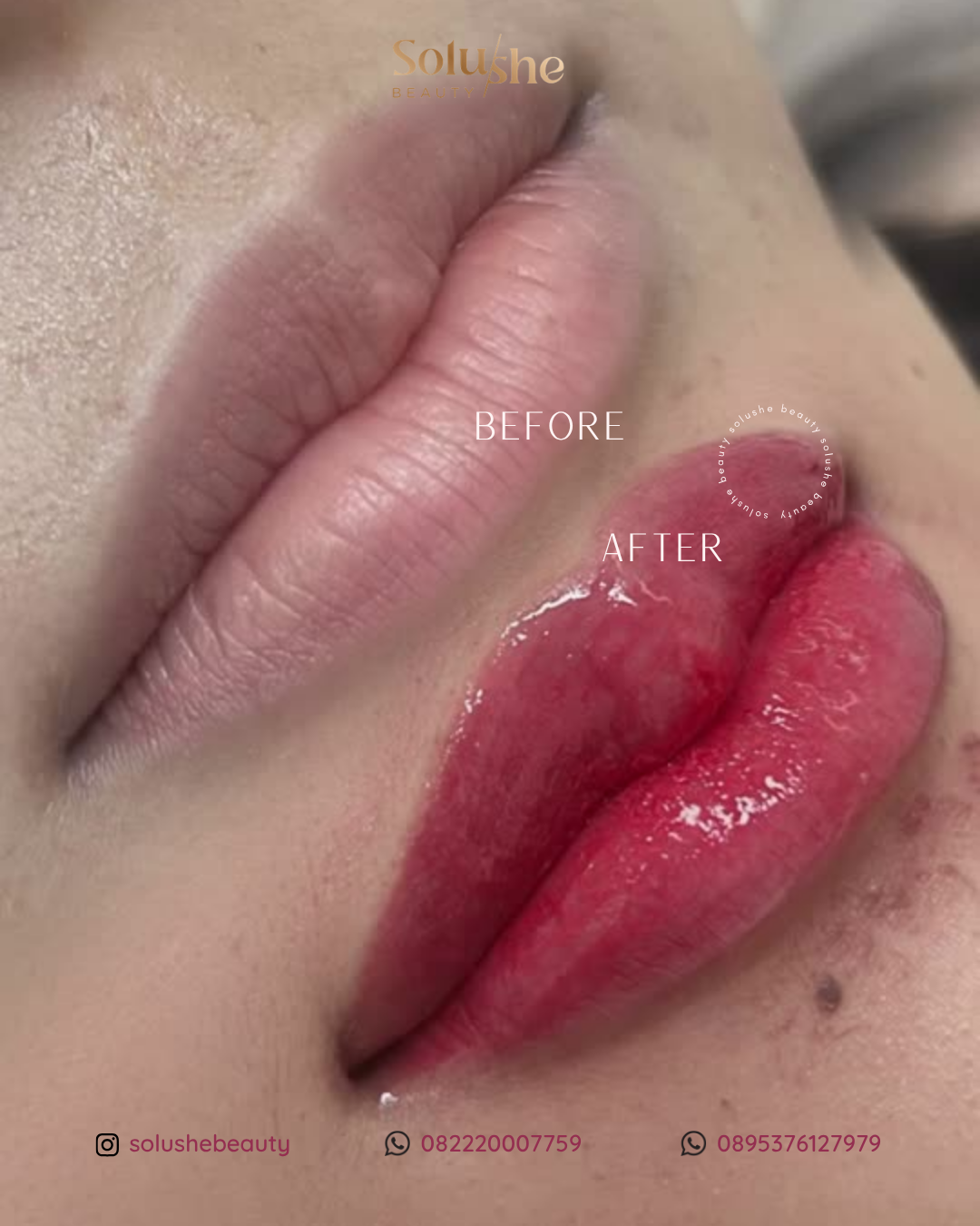 Hasil nyata before after Sulam Bibir by Owner Solushe