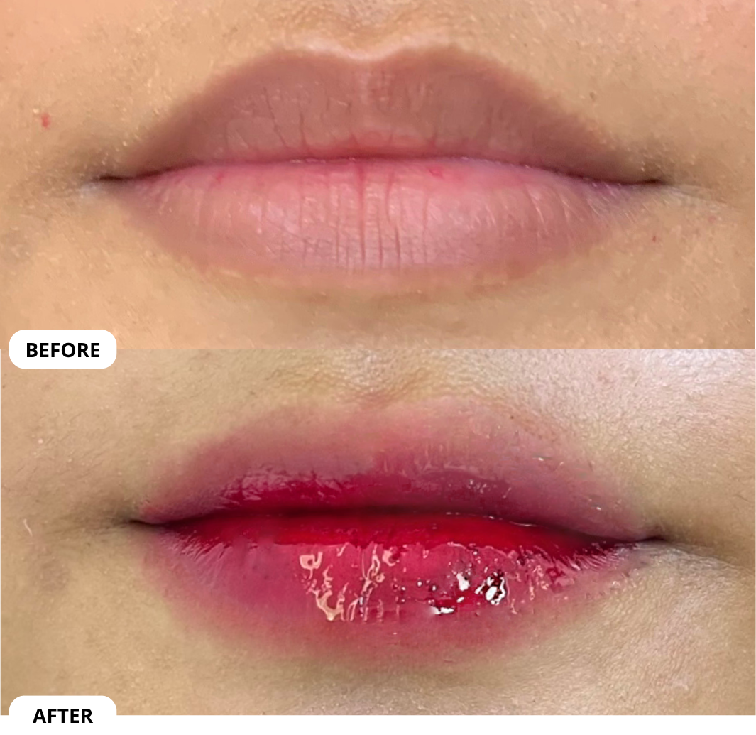 Hasil nyata before after Cherry Lips Solushe